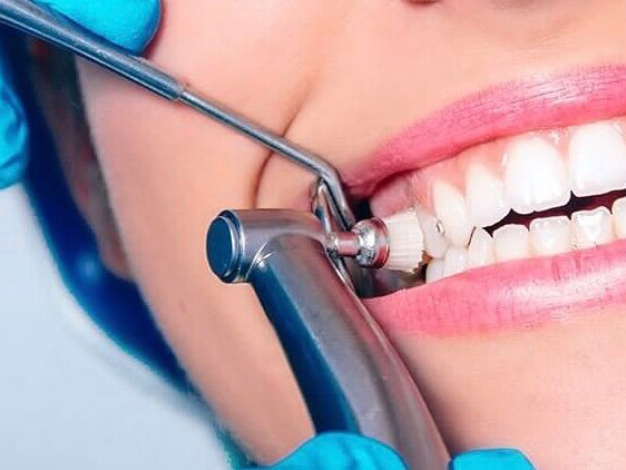 چگونه زیبایی دندان خود را بازسازی کنیم؟